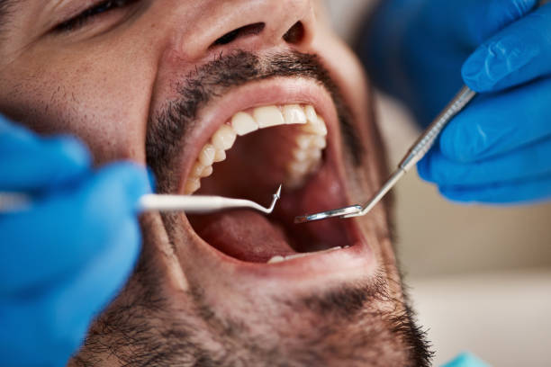 Best Emergency Dental Care for Broken or Chipped Teeth in Belding, MI